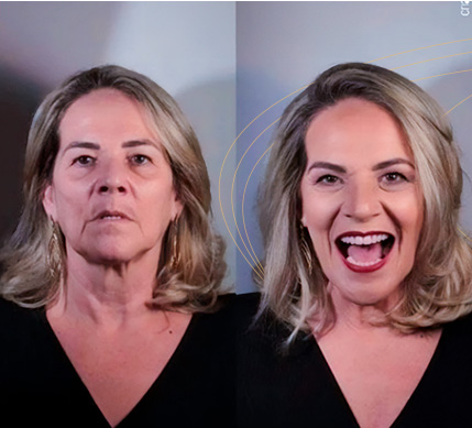 2antesedepois